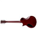 ESP E-II Eclipse Full Thickness Vintage Honey Burst